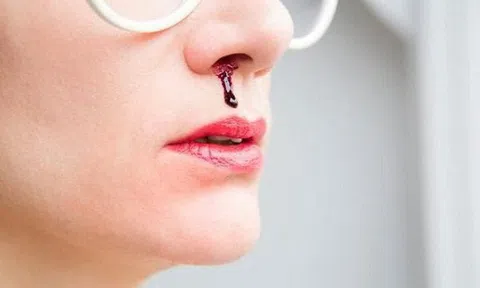 Cẩn thận với những triệu chứng bất thường ở mũi ngầm tố cáo sức khỏe của bạn đang gặp vấn đề