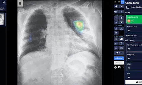 Vinbrain giành giải thưởng Quốc tế “công nghiệp ACM SIGAI 2021 cho sản phẩm trí tuệ nhân tạo xuất sắc nhất”
