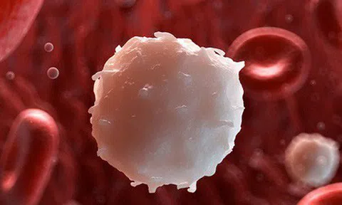 Ung thư máu: Những dấu hiệu nhận biết sớm và cảnh báo nhóm người có nguy cơ mắc bệnh cao