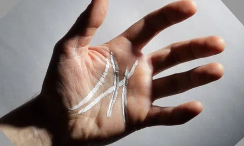 Nếu có dấu hiệu này trong lòng bàn tay, bạn sẽ cực kỳ giàu có và thành đạt