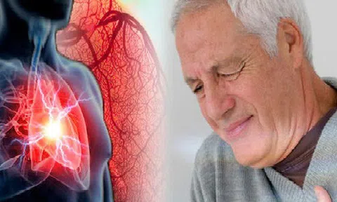 Thủ phạm gây tử vong hàng đầu ở VN: Cứ 10 người chết thì 8 người chết vì nguyên nhân này