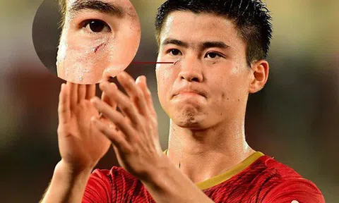 Nếu Việt Nam thua Iran, xin đừng quay lưng với những chàng trai đang hát vang Quốc ca Việt Nam ở đấu trường châu lục