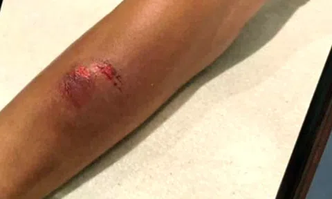 Nữ hành khách mang hành lý quá ký, lao vào cắn nhân viên hàng không