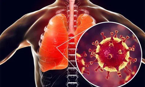 Các bệnh nhân thoát khỏi Covid-19 bằng cách nào?
