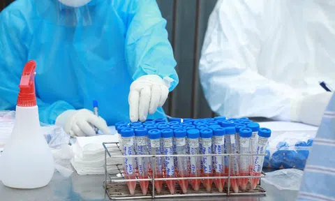 Bước đầu xác minh hơn 100 F1 liên quan ca Covid-19 là nhân viên Công ty Samsung